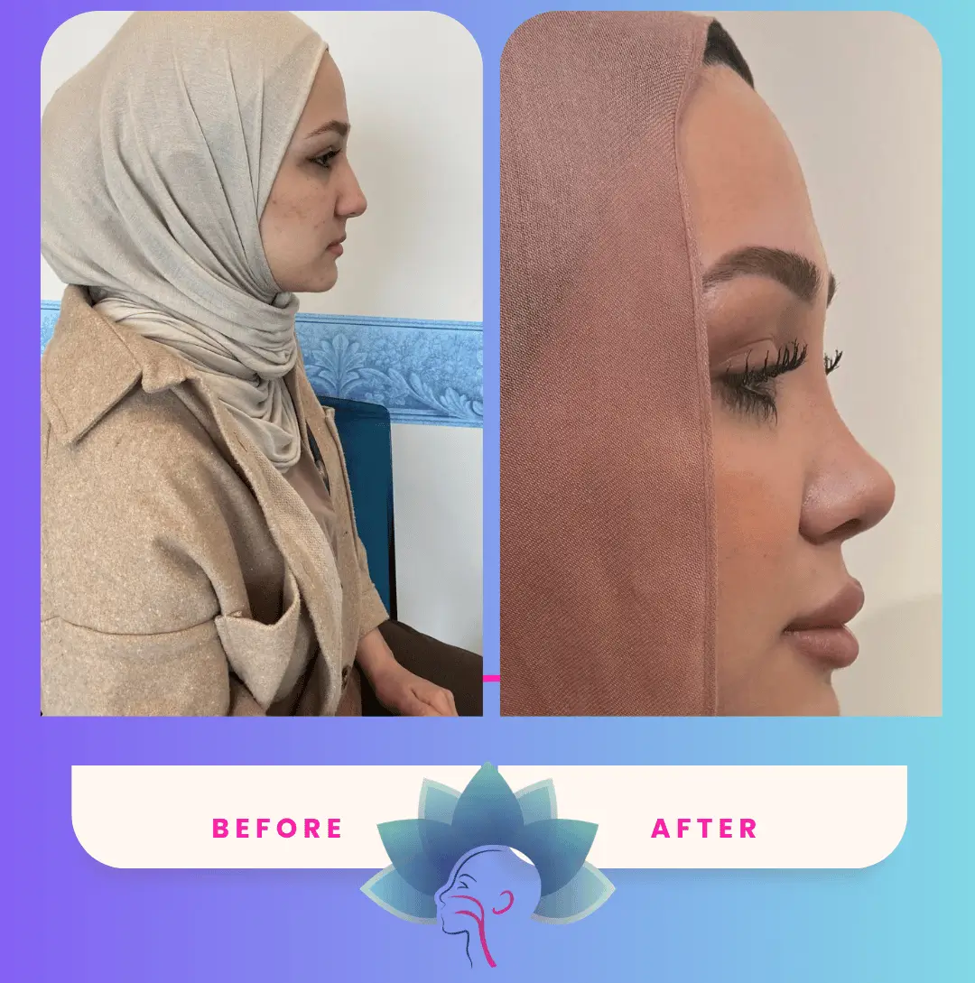 1 (5)